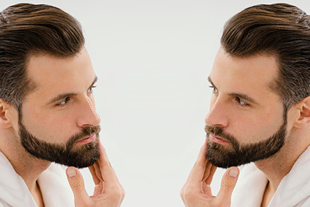 side-view-man-before-after-surgery